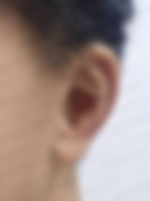 南京美莱整形美容医院口碑好不好：真实患者评价显优势