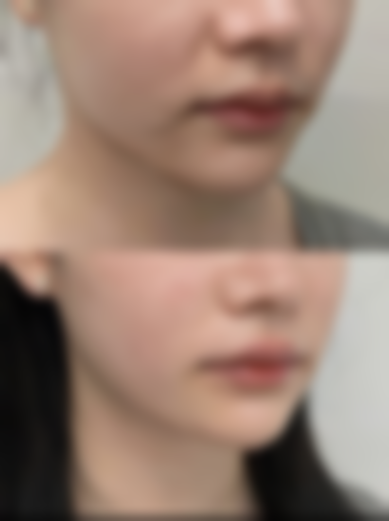 邹洁医生简介做手术价格