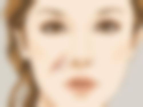 洪敏锡医生做手术价格