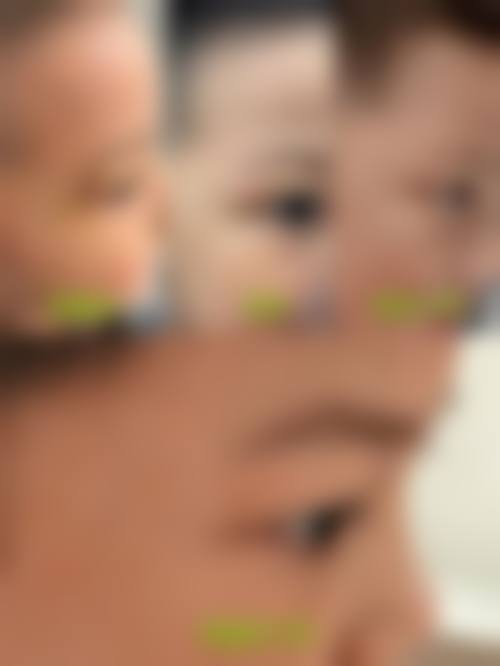 清远非梵整形医院价格表