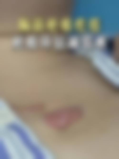 北京集美名媛医疗美容整形医院项目特色