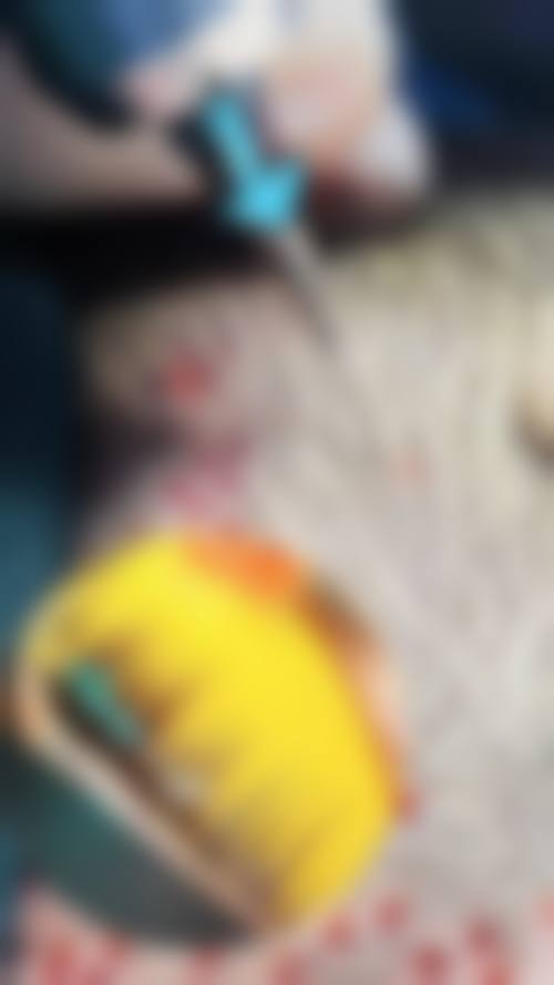 张佩莲医生项目优势解读