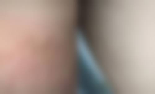 湖北武汉郡艺医疗美容门诊部怎么样