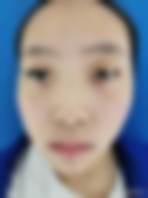 张佩莲医生口碑评价