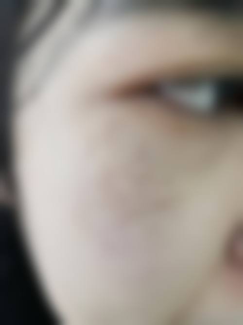 张佩莲医生做手术价格情况