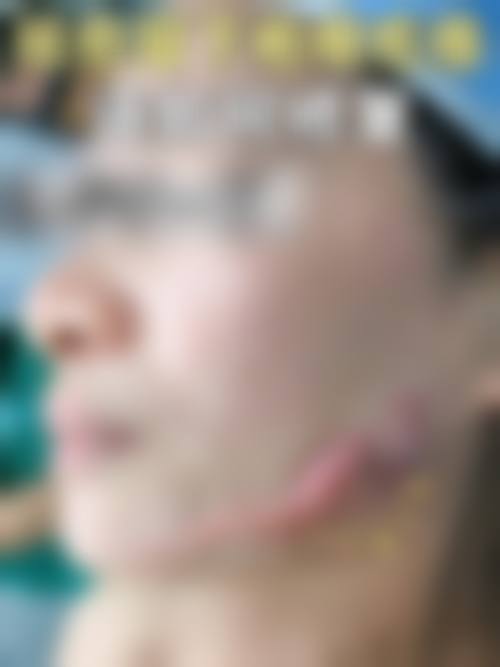 潍坊双华整形医院价格表