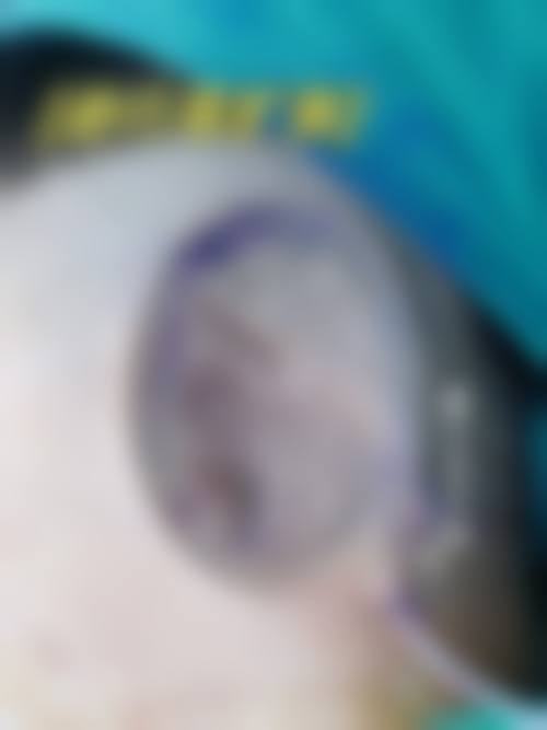 成都华人医联丽元整形口碑好不好