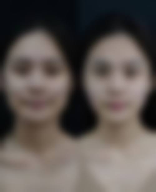 潍坊还幼医疗美容门诊部怎么样，顾客实例