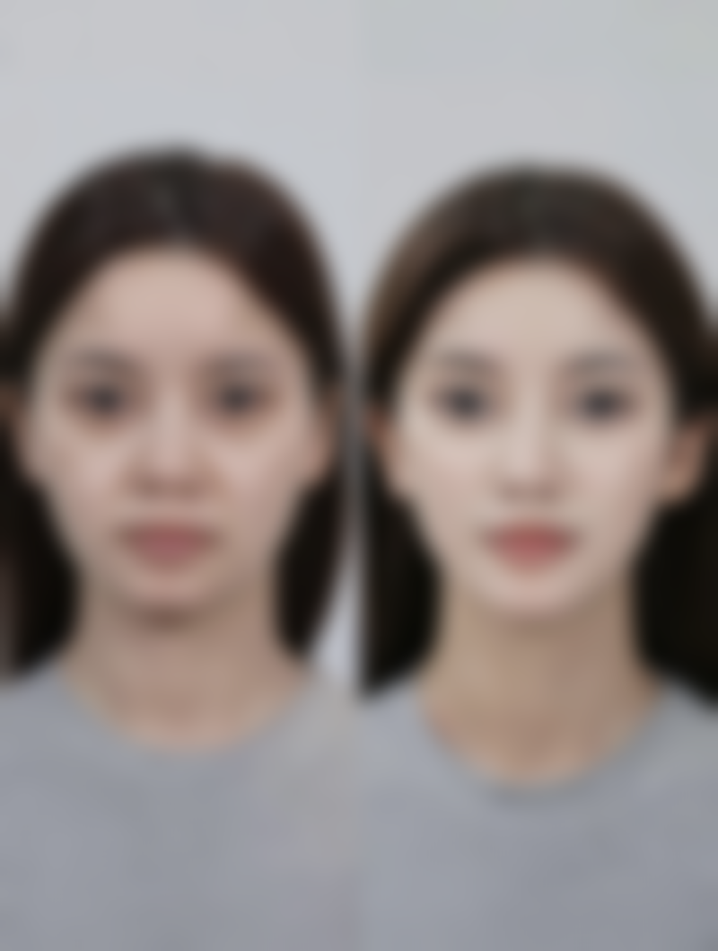 佛山汇莹源整形医院口碑评价如何