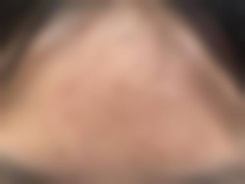 佛山幼真肤医学美容门诊部怎么样？价格表是怎样的？