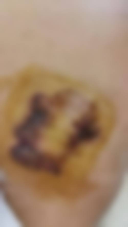南通英莎医疗美容门诊部术后疤痕修复项目的未来发展