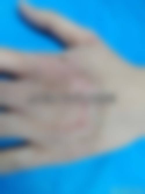 皖南医学校弋矶山医院整形外科价格表