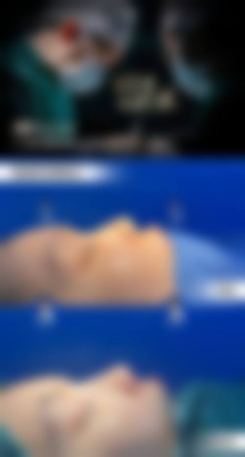 长沙艾泊(艾依美)医疗美容医院价格表