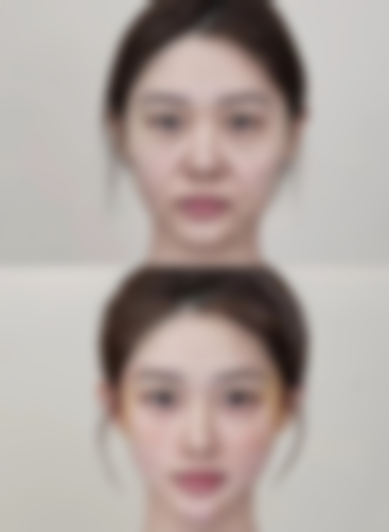 刘金红医生做手术价格