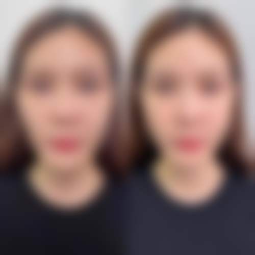 Dr.Akila医生怎么挂号