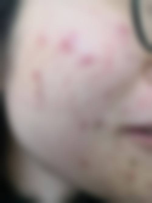 昆明首尔医疗美容诊所评价