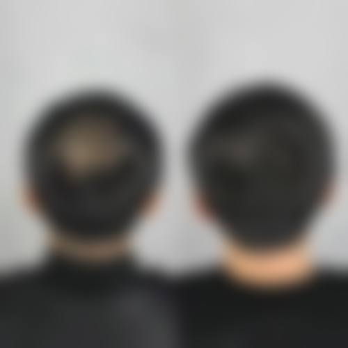 长沙妇幼保健院整形科怎么样：是否正规及特色项目