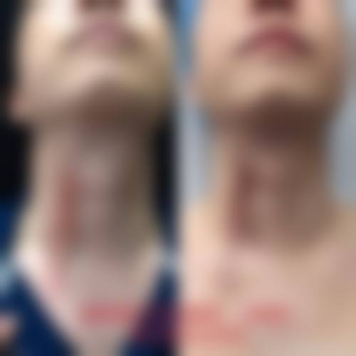 宜昌新美医疗美容门诊部顾客实例