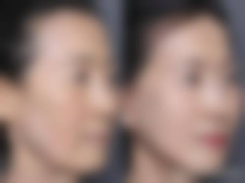 南京伊尔美医疗美容医院项目特色