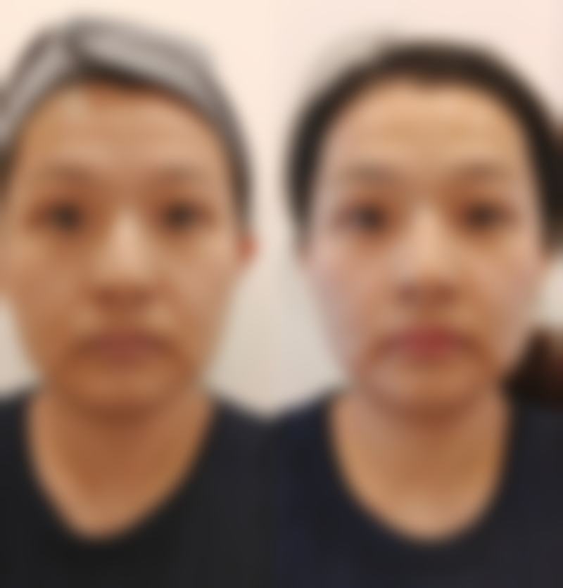 昆明首尔医疗美容诊所可靠吗