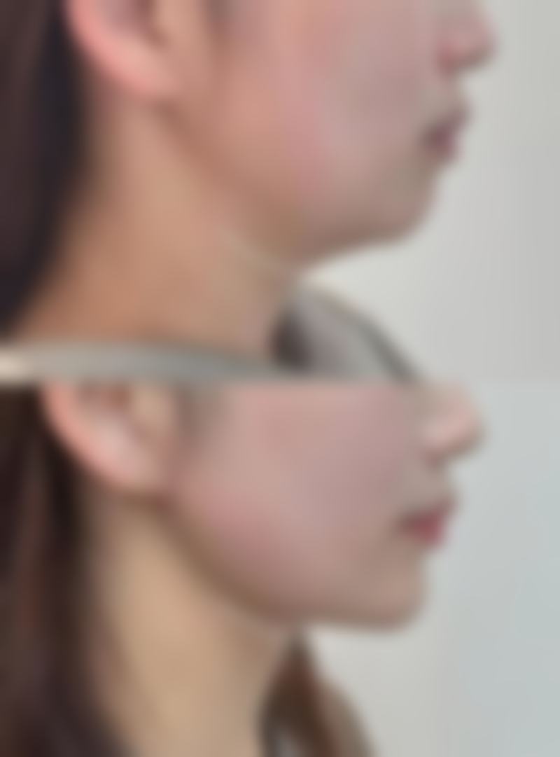 张俊峰医生口碑如何