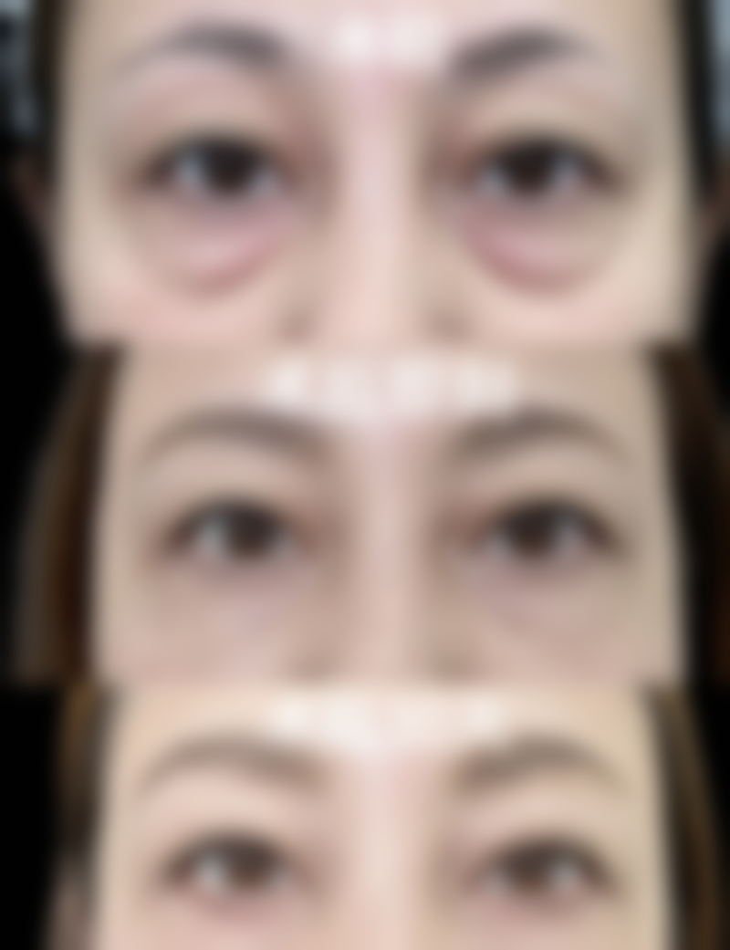 张俊峰医生项目优势