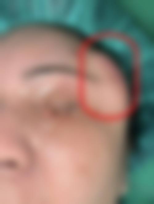 郑萍医生简介口碑如何