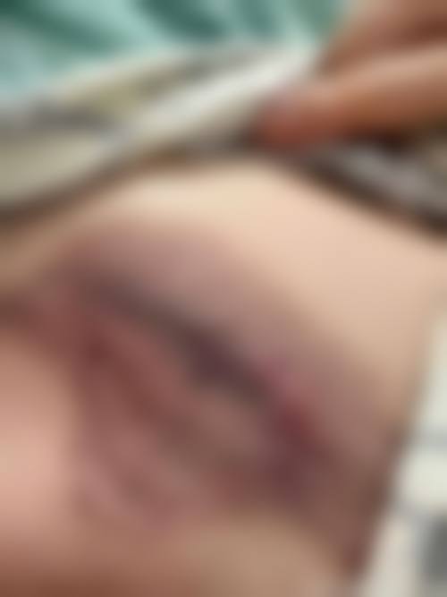 牛希华医生简介做手术价格