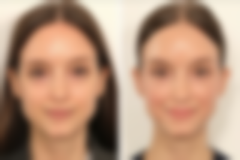 青海盈和医疗美容门诊部价格表