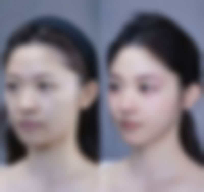 韩国JUM口腔颌面外科医院真实患者口碑评价