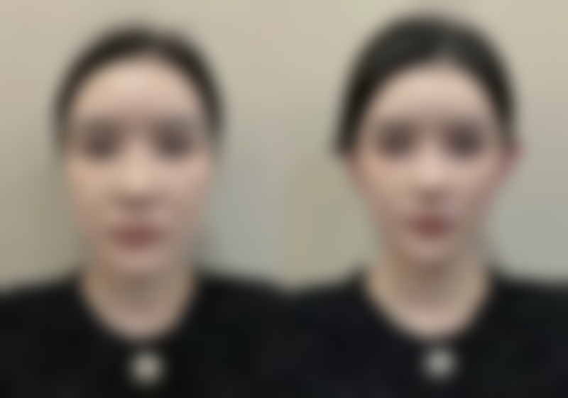 韩国JUM口腔颌面外科医院口碑评价