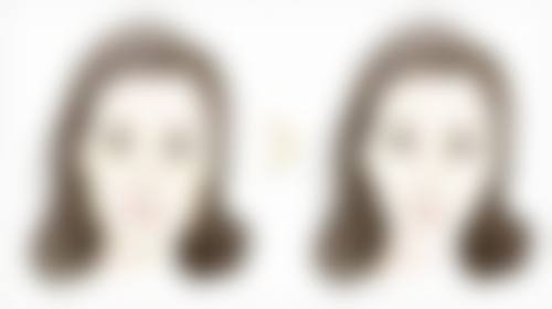 陈烈医生简介项目优势