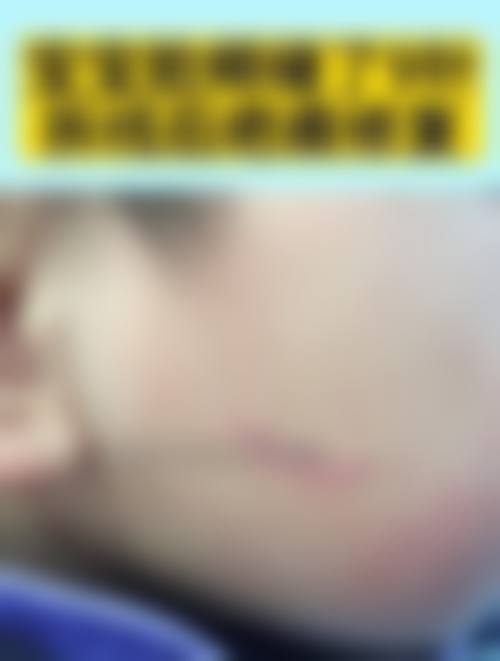 爱婷整形外科正规吗