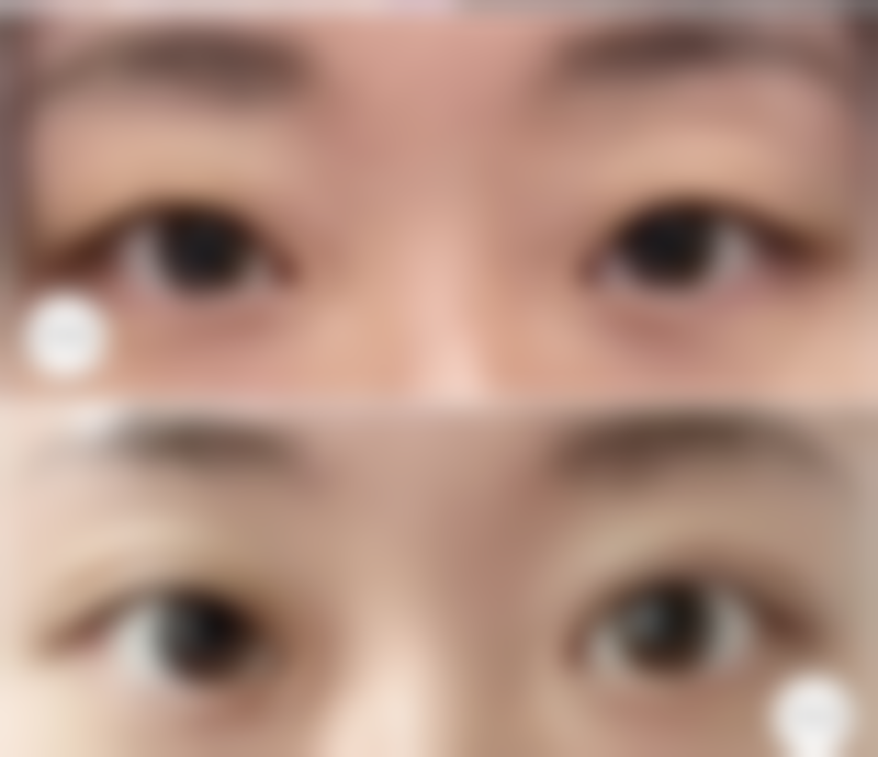 渭南玖玲靓星医疗美容诊所价格表