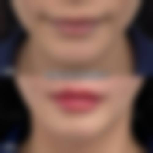 山东滨州华美整形医院口碑评价