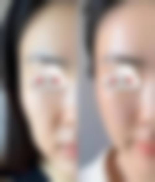 重庆华美整形医院怎么样，口碑评价如何？