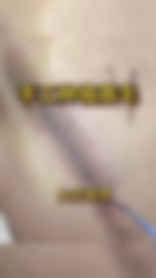 阜阳新生植发医院怎么样,口碑评价如何?