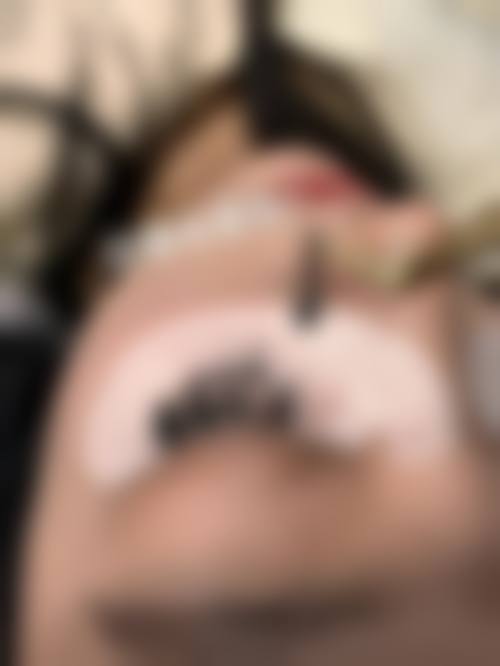 阜阳新生植发医院怎么样:地址及乘车路线