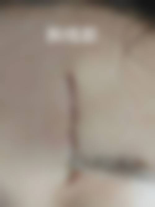 樊佃怀医生口碑如何