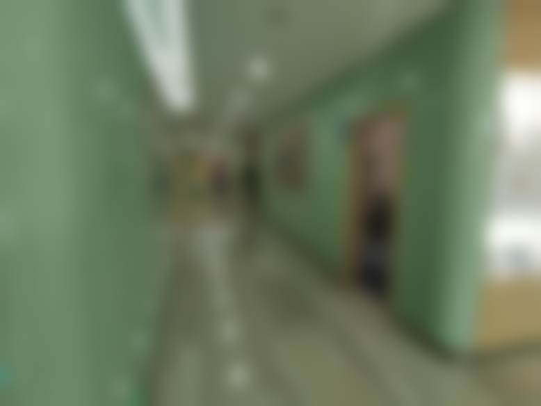 {肿眼泡单眼皮女生全切双眼皮开眼角成功案例，重庆联合丽格第五医疗美容医院量身定制方案，100天自然蜕变惊艳效果！