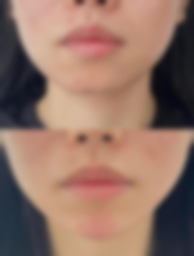 安永灿医生简介口碑如何