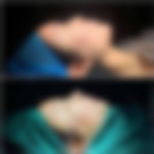 定边悦莱丽格医疗美容诊所更擅长什么手术