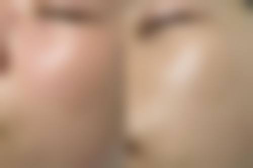 滨州丽都爱容整形医院口碑好不好