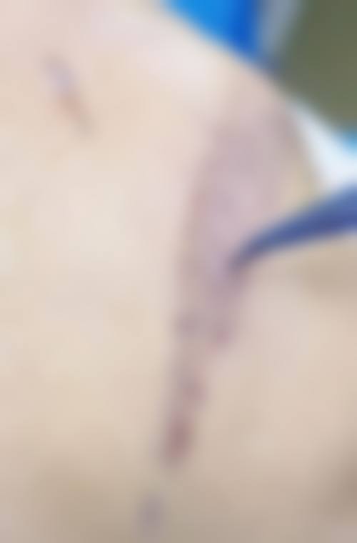 滨州医学校附属医院美容医学部怎么样，口碑评价如何？