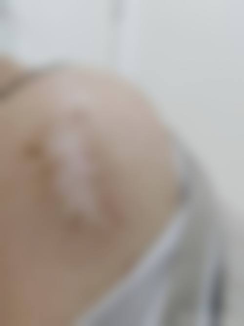 宪宗敏医生做手术价格