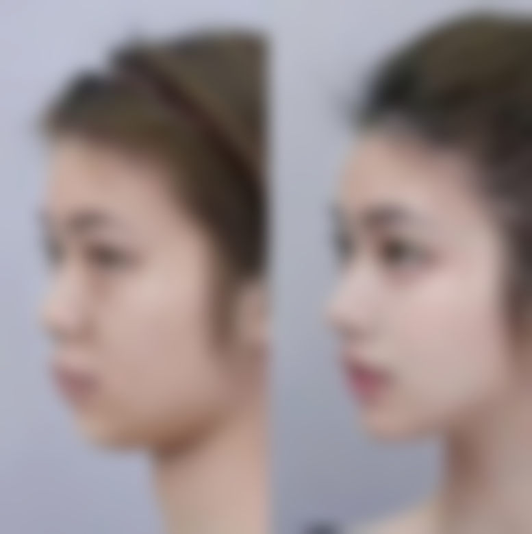 定边悦莱丽格医疗美容诊所可靠吗