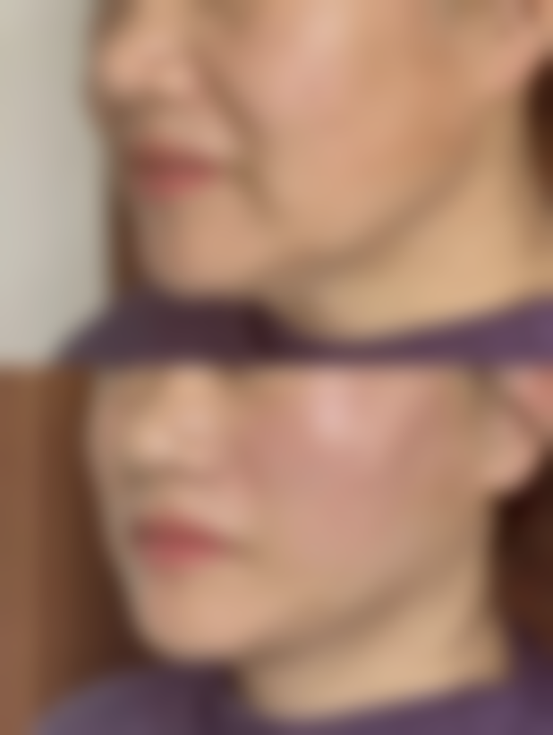 滨州丽都爱容整形医院项目特色