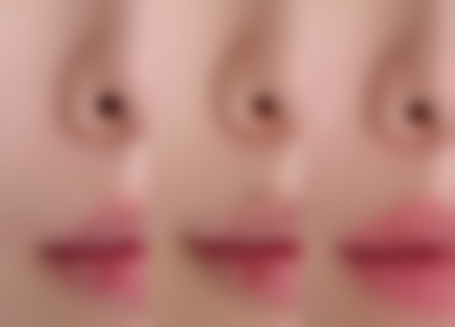 定边悦莱丽格医疗美容诊所价格表