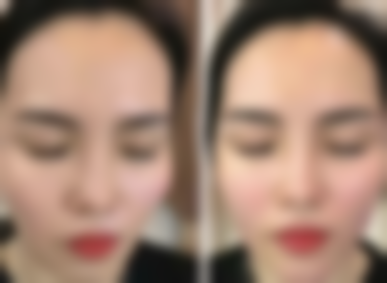 成都成华今美韶华整形医院口碑评价如何？