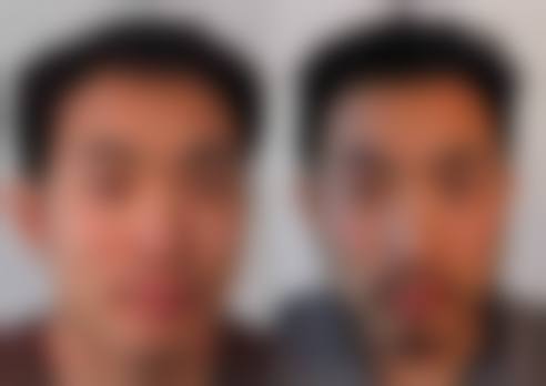 于腾阳医生简介项目优势